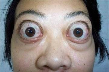 捏爆眼球吃瓜视频,眼球炸裂！揭秘捏爆眼球吃瓜视频背后的惊人真相