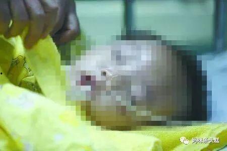 吃木鳖瓜死亡案例视频,食用木鳖瓜致人死亡，揭秘致命瓜果真相