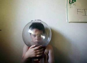 自闭症可以吃小瓜吗视频,小瓜在自闭症饮食中的角色